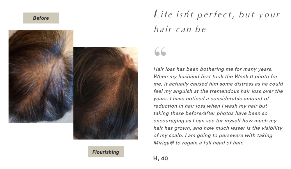 miriqa-hair-testi05 miriqa-hair-testi05